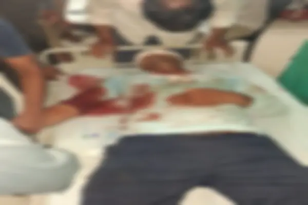 फोटोकॉपी कराने दुकान पर पहुंचे LIC एजेंट को दो हमलावरों ने मारी गोली
